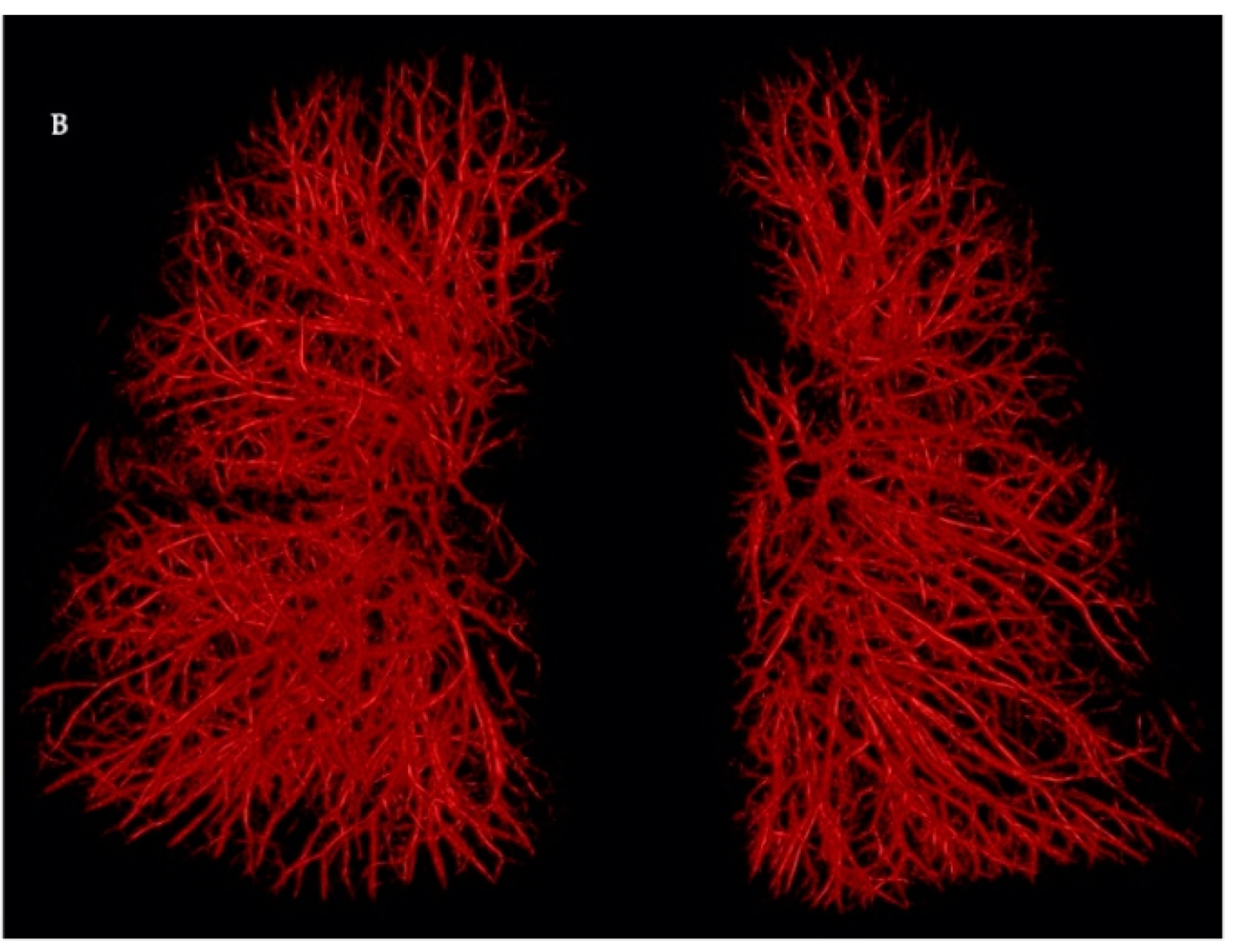 A photograph shows a latex cast of the pulmonary circulation. The cast is red branching network structure that form the shape of two lungs. 