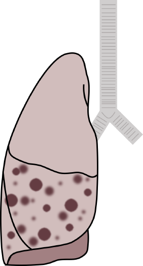 table 3.2 left.svg.png