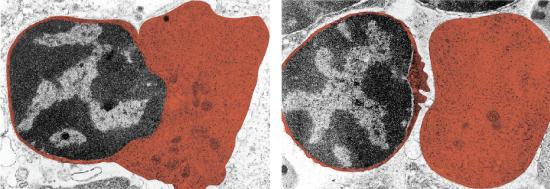 Micrograph of red blood cell ejecting its nucleus