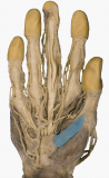 Muscles_Flexor_Pollicis_Brevis_Cadaver.png