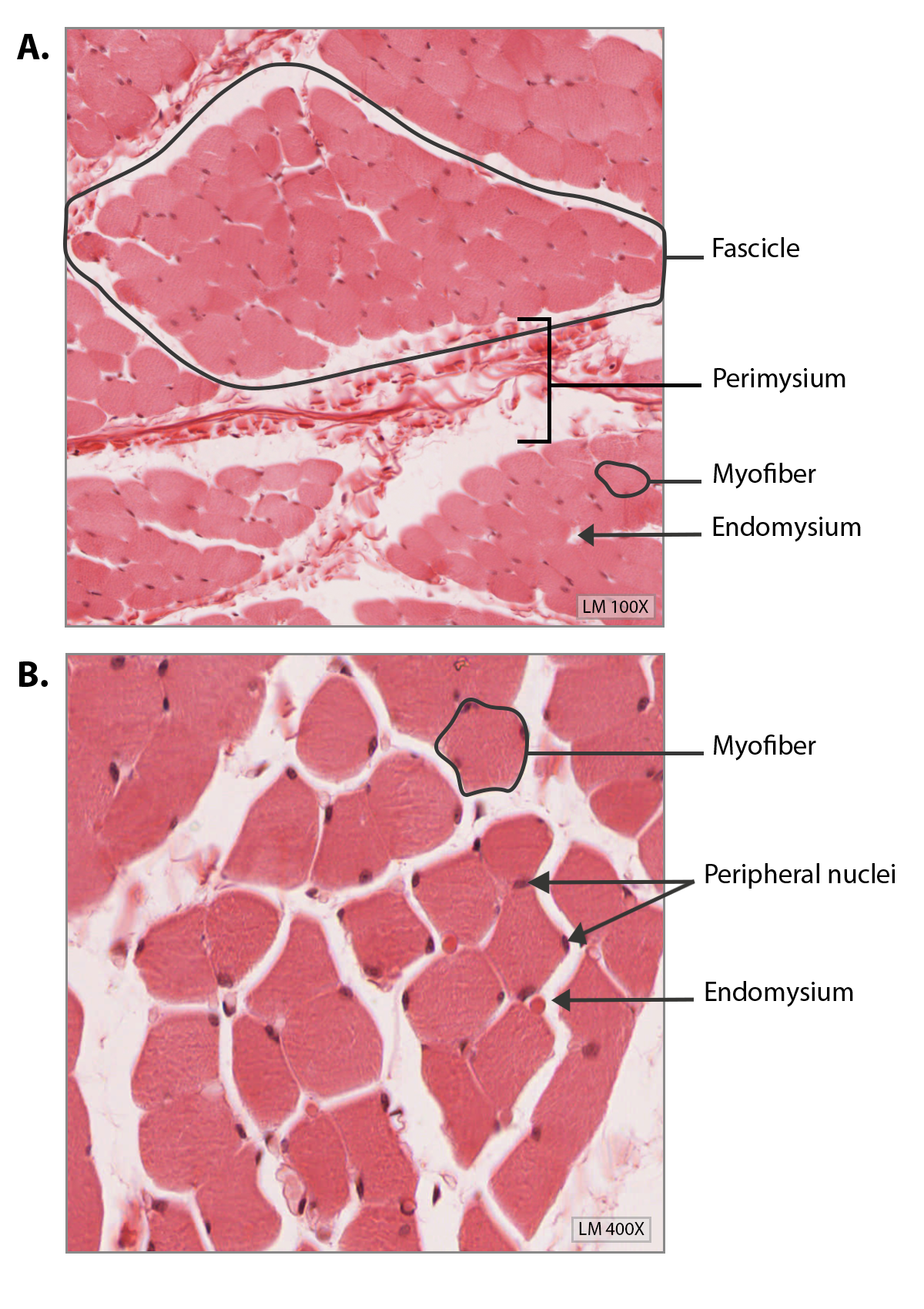 skeletal muscle histology labeled