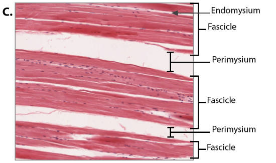 Skeletal_Muscle_Long_Section_100x_Fascicles.PNG