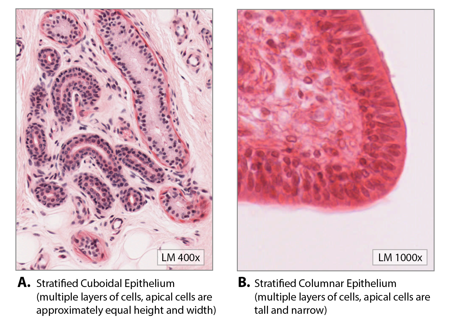 Stratified_Cuboidal_and_Stratified_Columnar_Epithelia_Histology.png