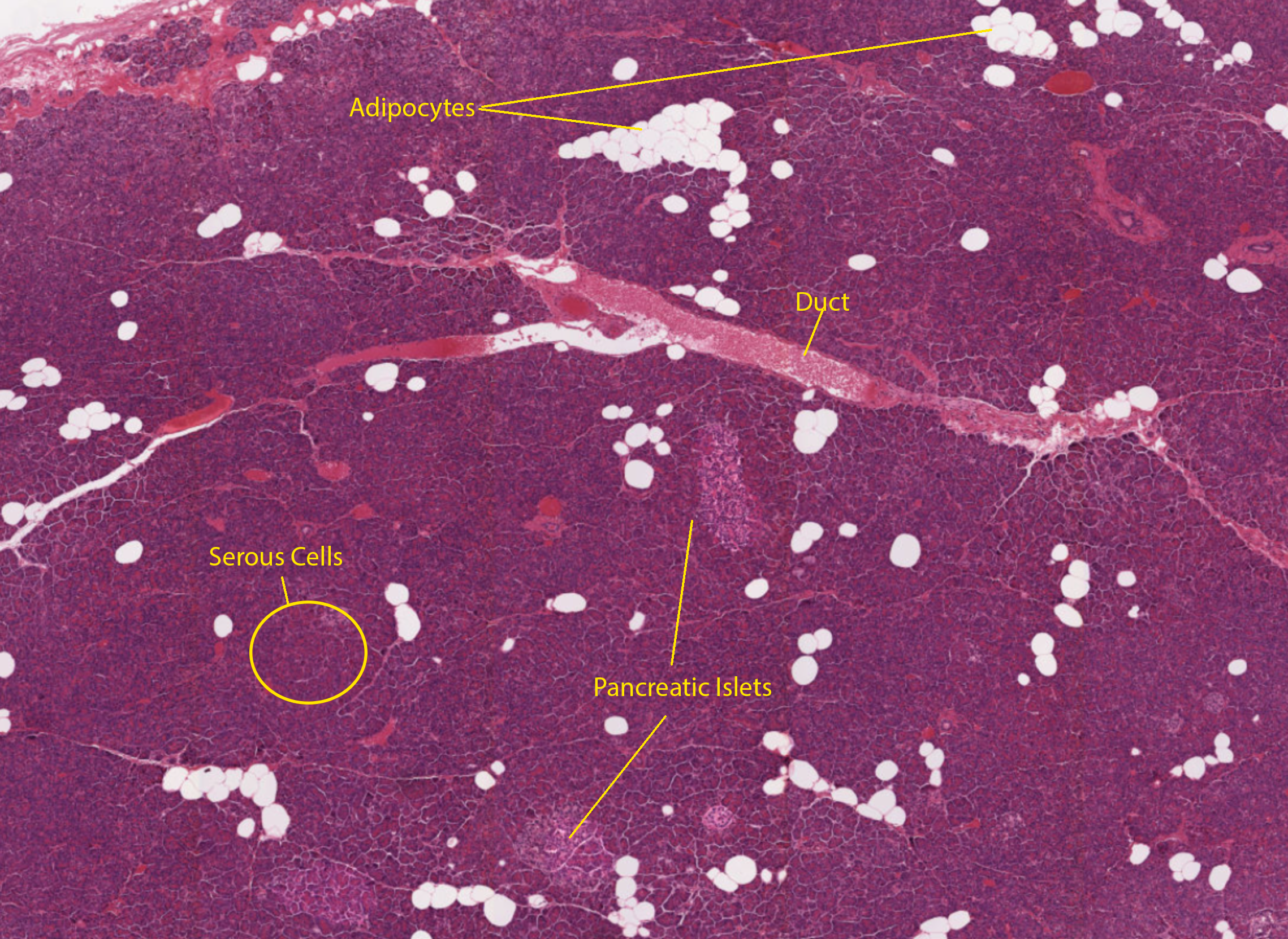 Pancreas 100 times