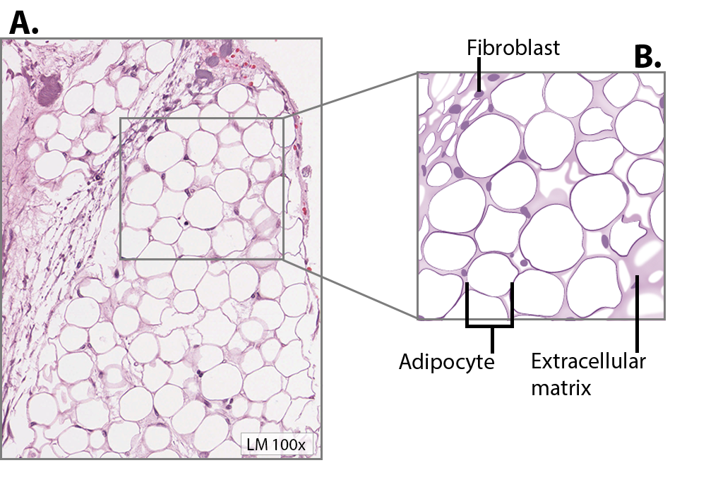Adipose_Connective_Tissue_with_Enlargement.png