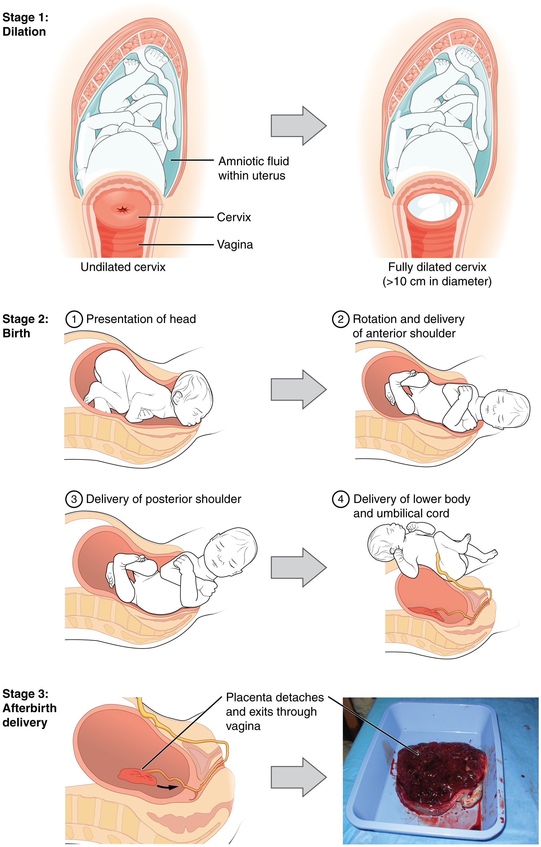 This multi-part figure shows the different stages of childbirth. The top panel shows dilation of the cervix (undilated vs fully dilated), the middle panel shows birth (presentation of the head, rotation and delivery of anterior shoulder, delivery of posterior shoulder, delivery of lower body and umbilical cord), and the bottom panel shows afterbirth delivery.