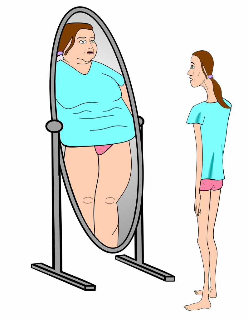 Ilustración que muestra a una persona delgada mirándose en un espejo y viéndose a sí misma mucho más grande para mostrar la percepción corporal de una persona con anorexia nerviosa