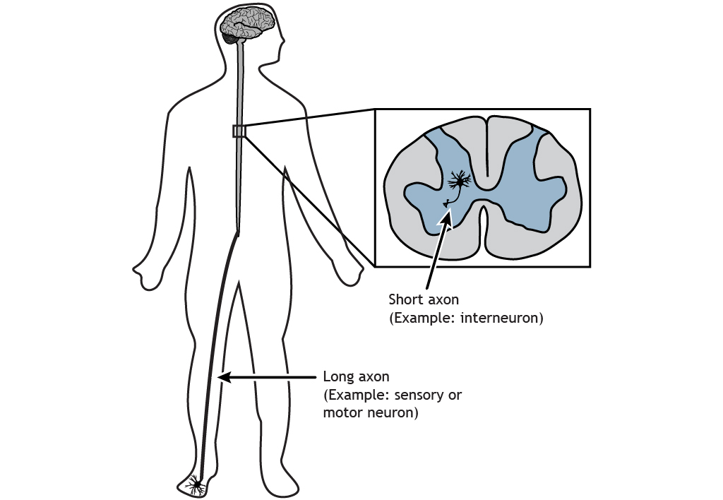 Cuerpo humano ilustrado mostrando un axón corto y un axón largo. Detalles en pie de foto.