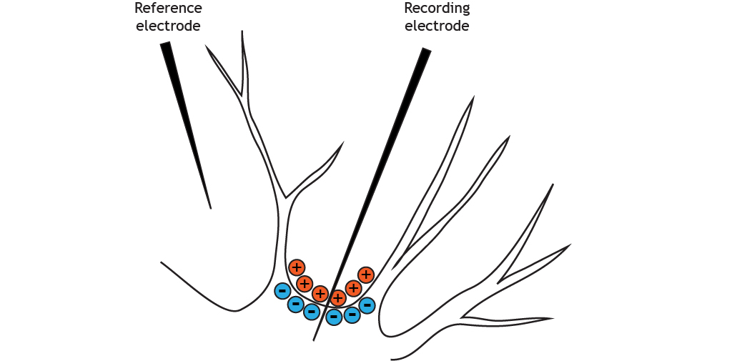 La sección ilustrada de un cuerpo celular neuronal muestra una solución intracelular cargada negativamente.