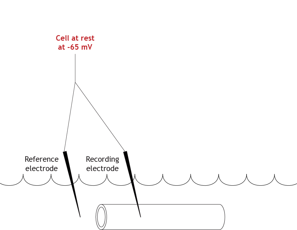 Axon ilustrado con potencial de membrana en reposo de -65 mV. Detalles en pie de foto.