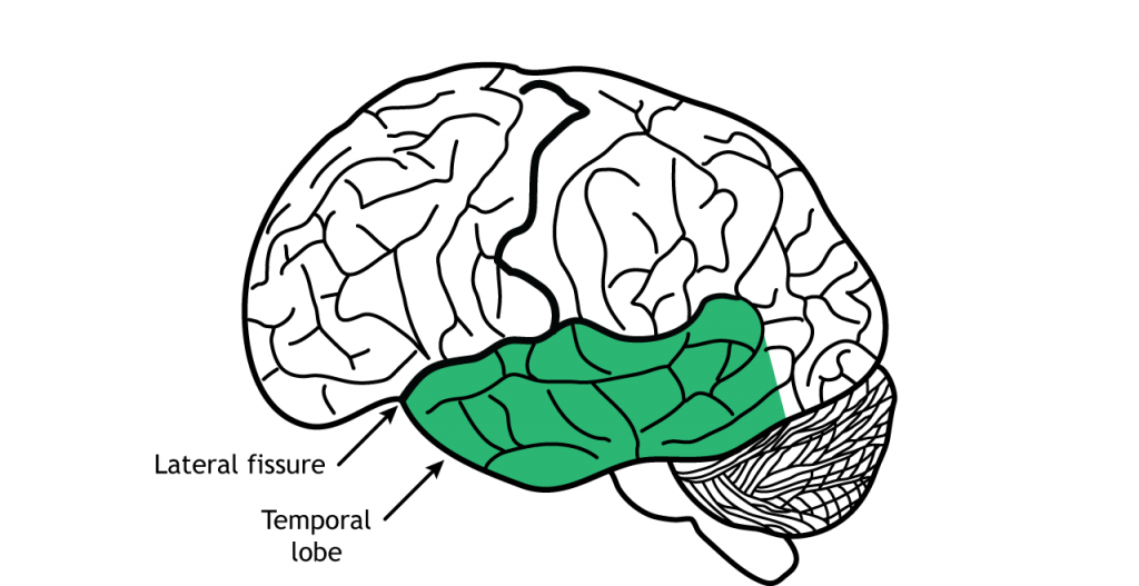 Ilustración del cerebro mostrando el lóbulo temporal. Detalles en texto.