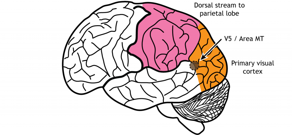 Illustration of the brain showing area MT near the occipital lobe, temporal lobe, parietal lobe junction. Details in caption.