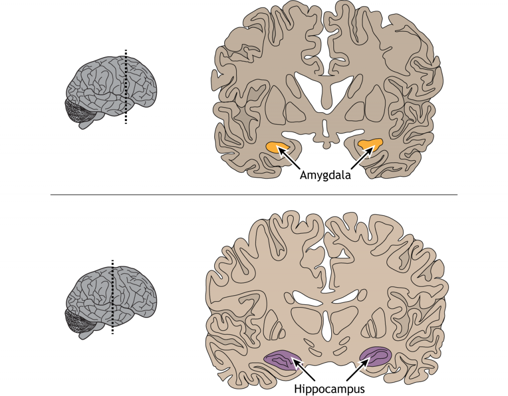 Ilustración de secciones cerebrales coronales que muestran la ubicación de la amígdala y el hipocampo. Detalles en pie de foto.