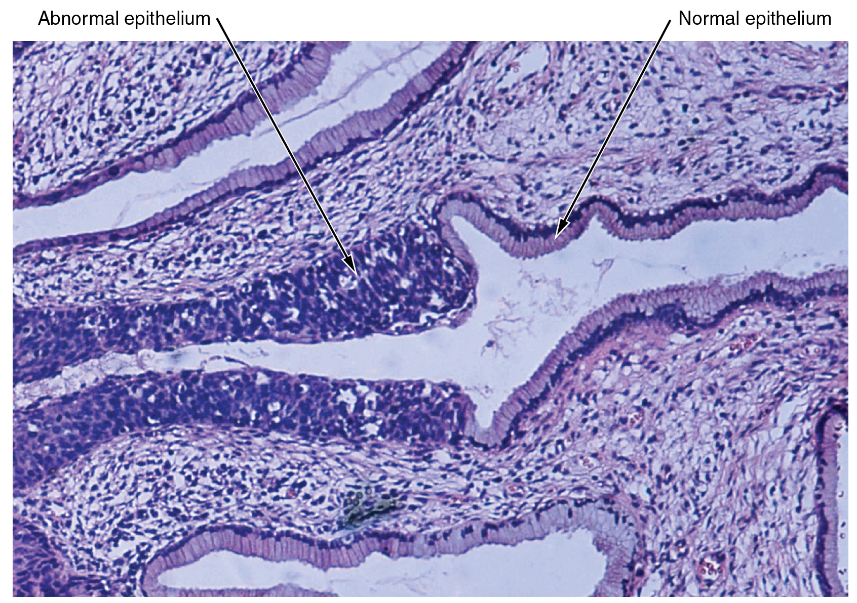 400_Micrograph_of_Cervical_Tissue_updated.jpg