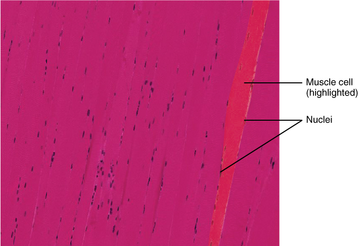 Micrograph hii inaonyesha seli ya misuli yenye nuclei nyingi.