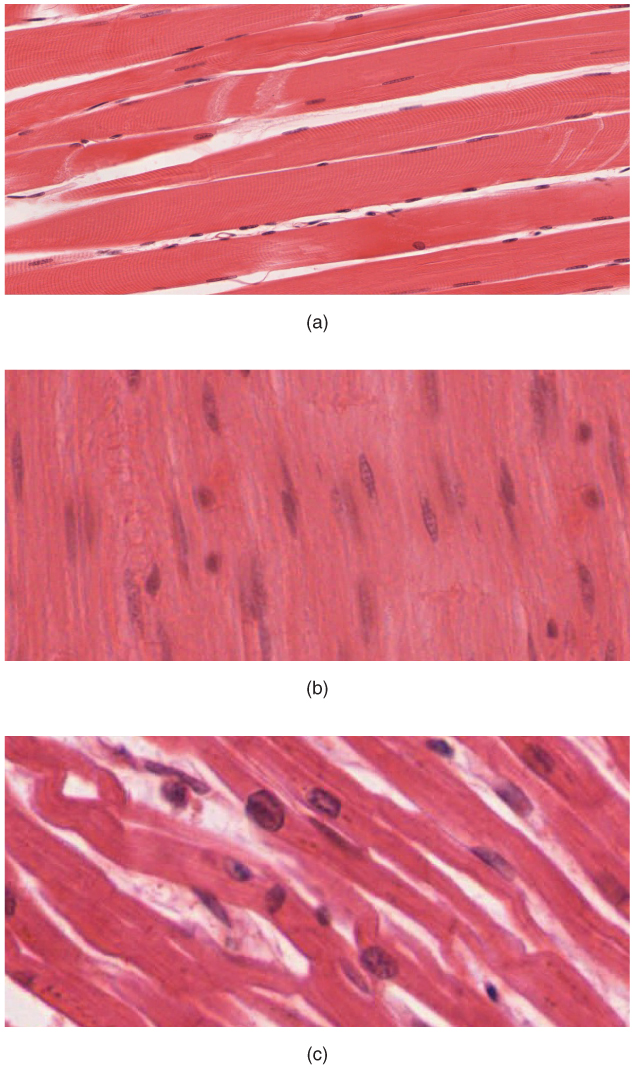 Esta figura mostra as micrografias do músculo esquelético, do músculo liso e das células do músculo cardíaco.