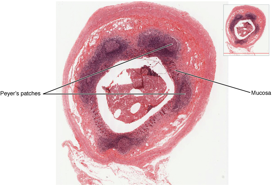 Esta figura mostra uma micrografia de um nódulo de tecido linfóide associado à mucosa.