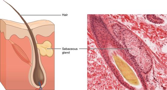 Sebaceous gland associated with a hair follicle seen in a drawing and in a micrograph