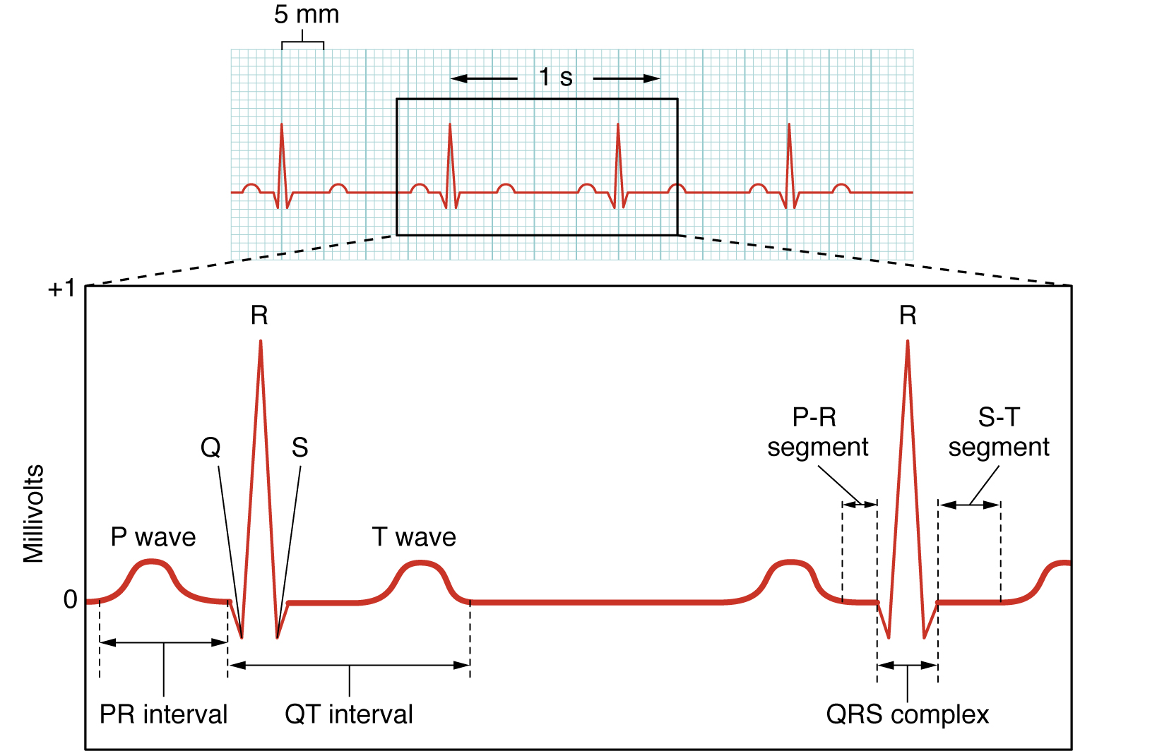 Esta figura mostra um gráfico de milivolts ao longo do tempo e dos ciclos cardíacos durante um ECG.