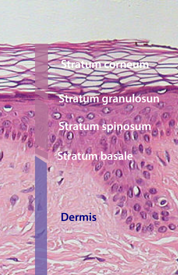 Epidermal layers thin skin 100x
