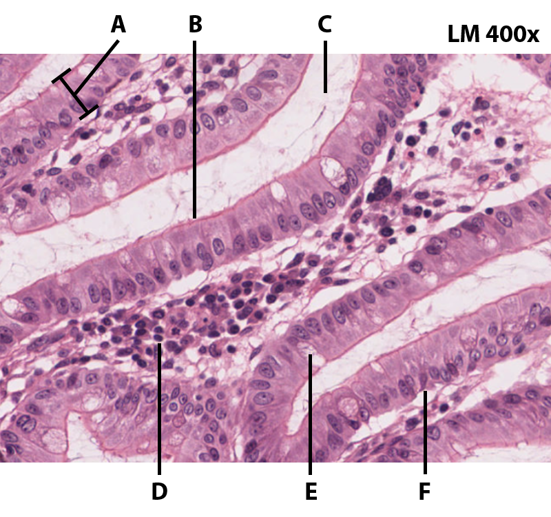 Simple Columnar Epithelium Histology @400x.png