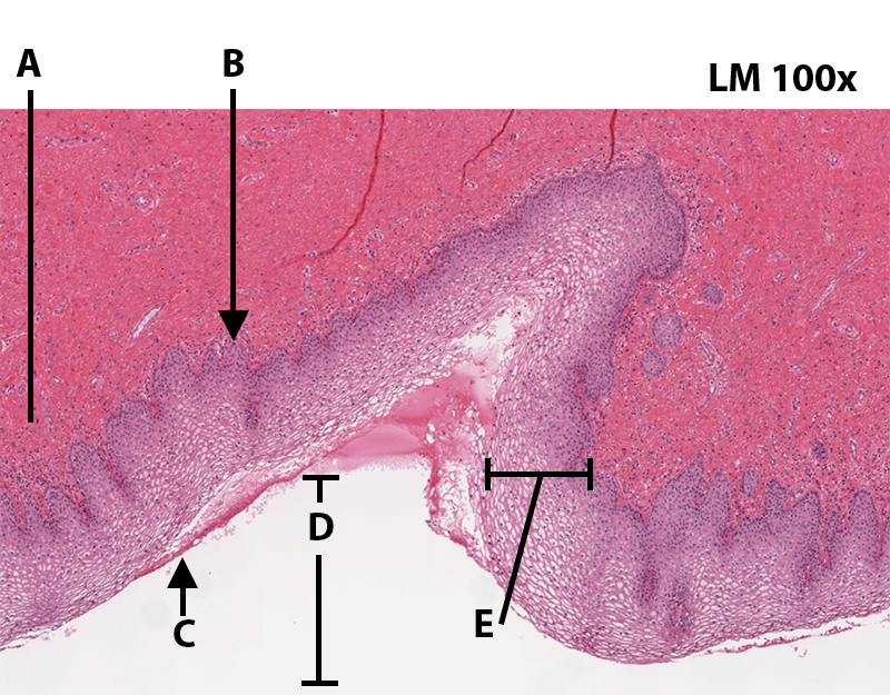 Stratified Squamous Epithelium Histology @100x.png