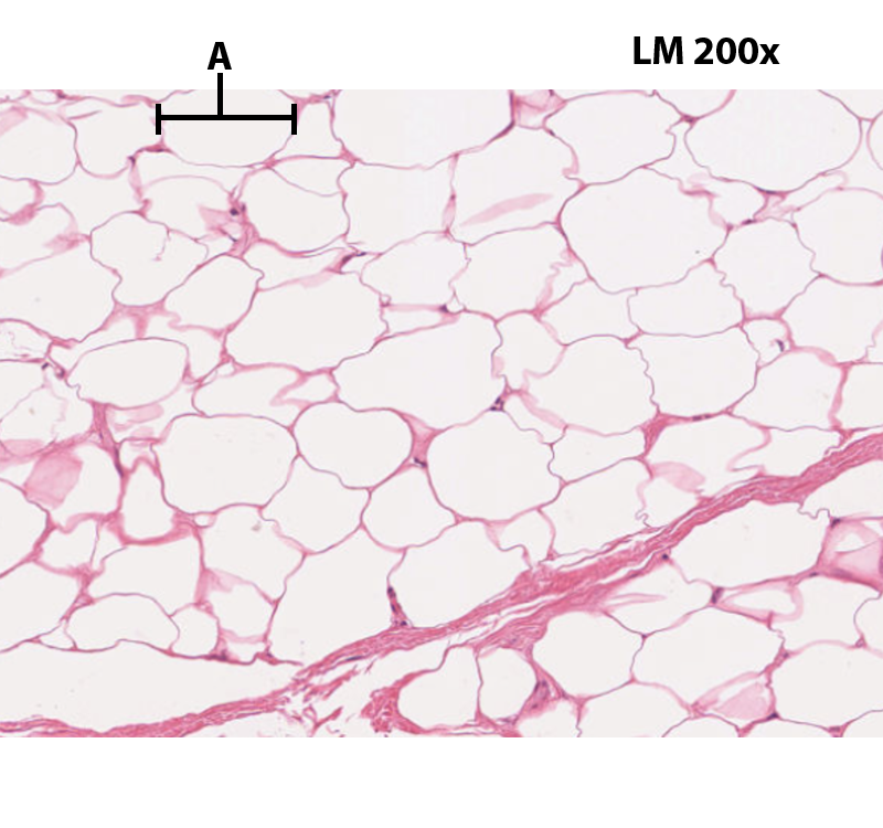 Adipose Connective Tissue @200x.png