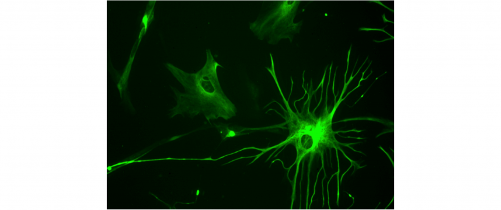 Image of an astrocytes stained with fluorescent green marker