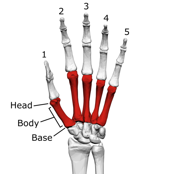 This is a color illustration of the metacarpal bones of the left hand. It shows how the metacarpals connect the carpal bones of the wrist with the phalanges (finger bones). A phalange is labeled to show its head, body, and base.