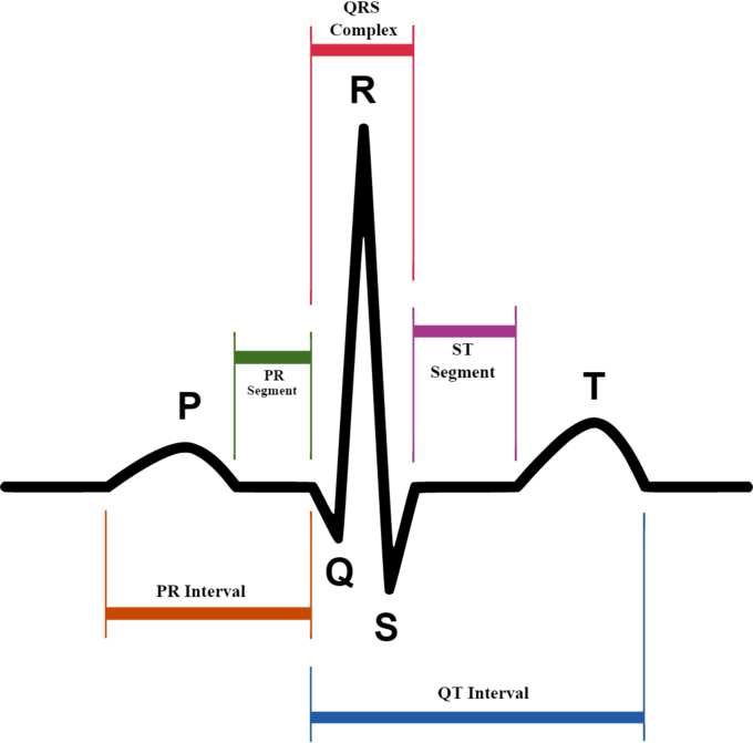 ECG graph of a normal heartbeat indicating QRS complex, PR segment, ST segment, PR interval, and QT interval.