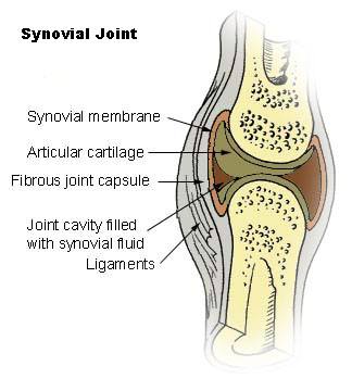 This illustration is a cutaway image of a synovial joint showing the location of the synovial membrane. The synovial membrane is soft tissue surrounding the joint cavity, which is filled with synovial fluid. Ligaments and the fibrous joint capsule surround the outside of the synovial membrane. The articular cartilage is inside the synovial membrane and cushions the bones at the joint.