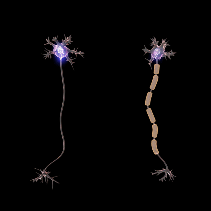 This is an image of saltatory conduction. It shows the faster propagation of an action potential in myelinated neurons than that of unmyelinated neurons.