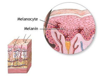 This is an image of a cross-section of skin that shows melanin in melanocytes.