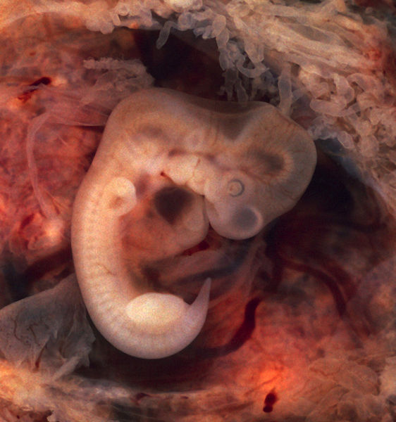 This is a scan of a human embryo at seven weeks—an embryo from an ectopic pregnancy, still in the oviduct. This embryo is about five weeks old (or from the seventh week of menstrual age). The heart is the dark spot at the center of the image, bulging out of the embryo.