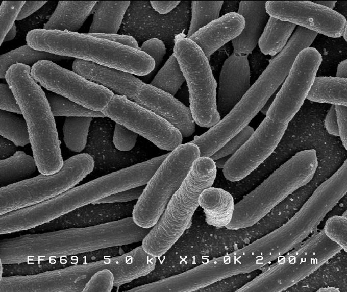 Electron-micrograph of Escherichia coli, a common species of bacteria present in the human gut.