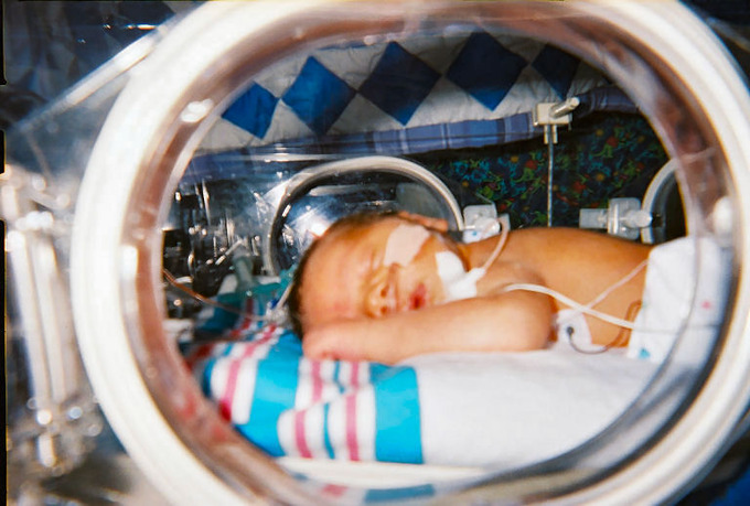 This is a photograph of an infant in an incubator. Infants, especially preterm infants, have trouble regulating their body temperature. Placement in an incubator allows them to adjust without draining their energy stores.