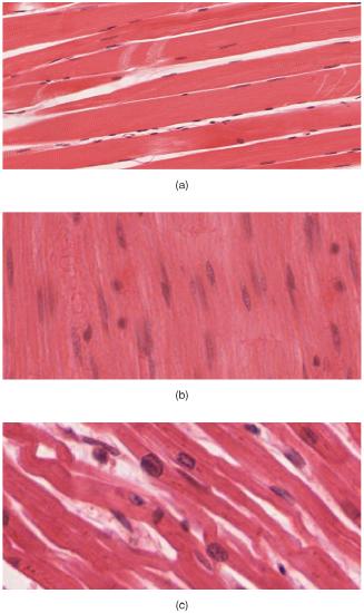 Skeletal, Smooth, and Cardiac muscle tissue as viewed under the microscope 