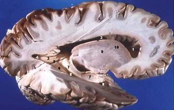 A lateral cross-section of the human brain