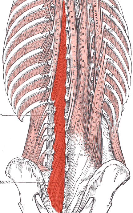This diagram depicts the multifidus in relation to the sacrum, sacrospinalis, semispinalis, and spinalis dorsi.