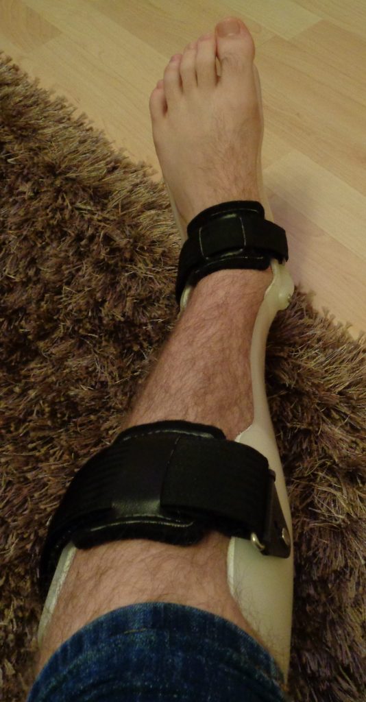 Photo showing Supportive Brace to Prevent Foot Drop in use