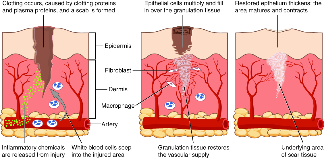 The process of tissue repair