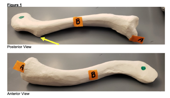 3.3: Practice for Bones and Bone Markings - Medicine LibreTexts