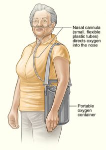 An elderly woman stands upright with an attached nasal cannula. She discretely carries her extra oxygen in a handbag.