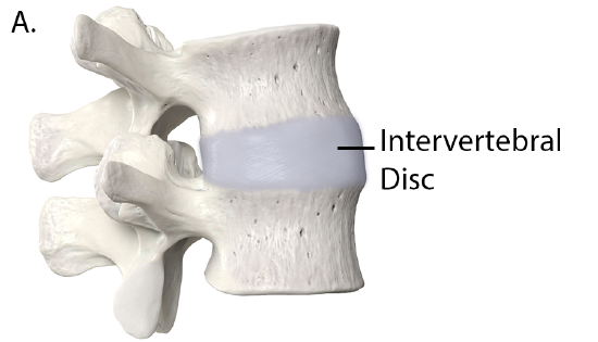 Intervertebral Disc Lateral View