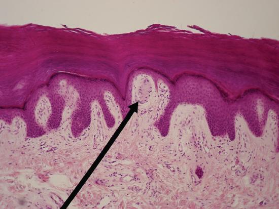 Skin as viewed under the microscope showing a meissner corpuscle
