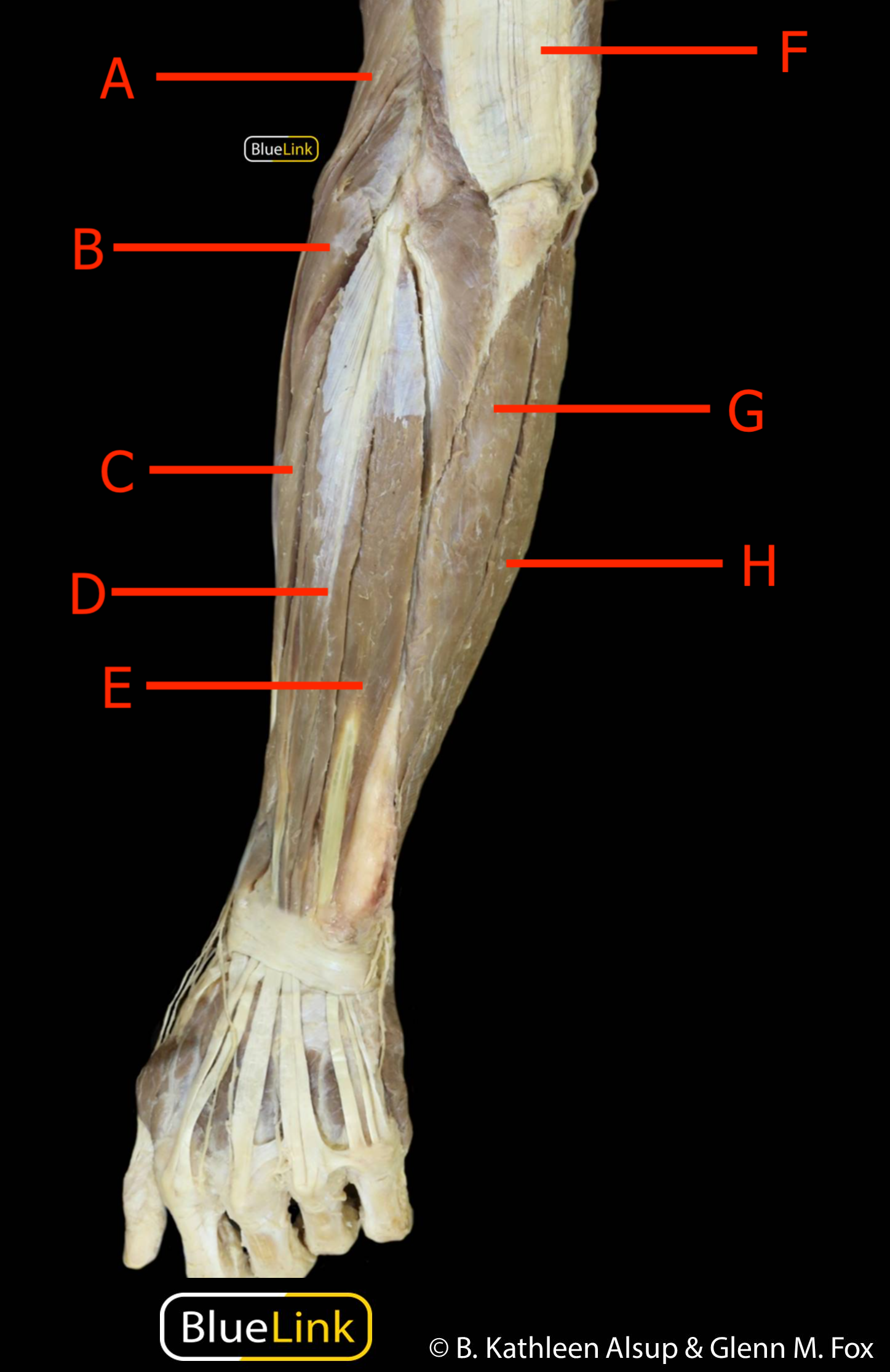 UL Overview of Upper Limb 16 (1).png