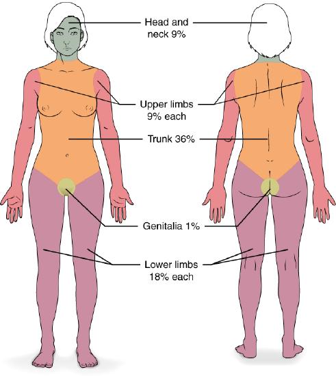 Specific parts of the body are highlighted to show percentage of body area.