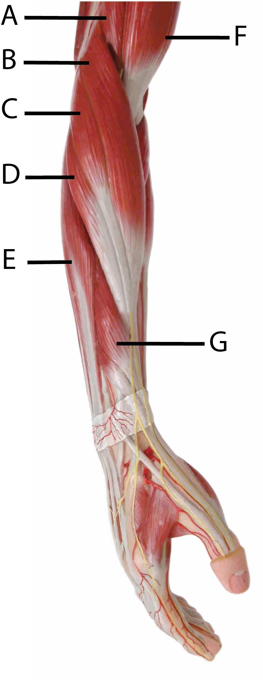 Forearm Model Medial View with Letters