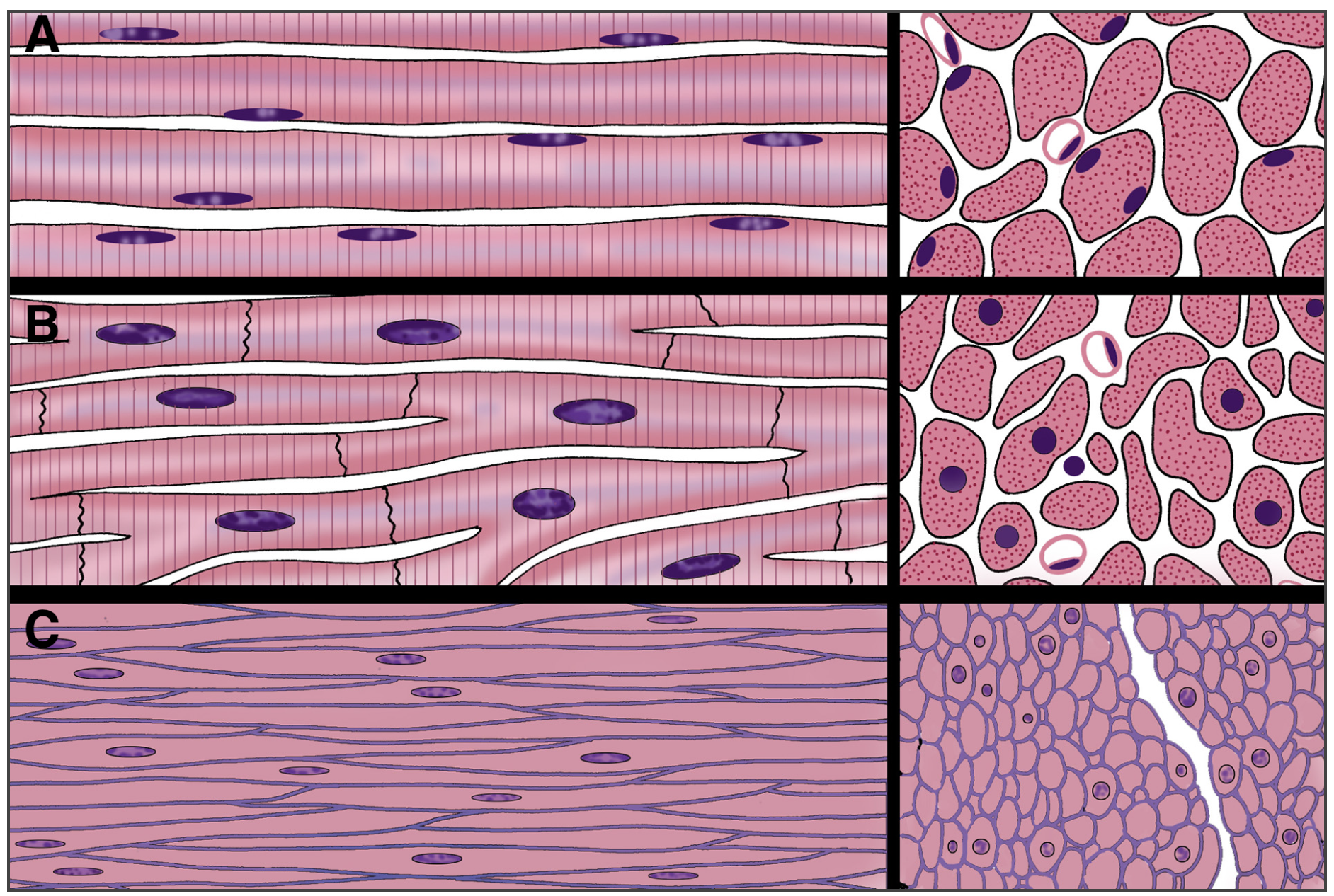 Comparison of muscle tissue types (illustration) - A. skeletal, B. cardiac, C. smooth.png