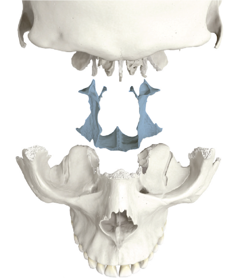 Palatine Bone Ex Situ anterosuperior view